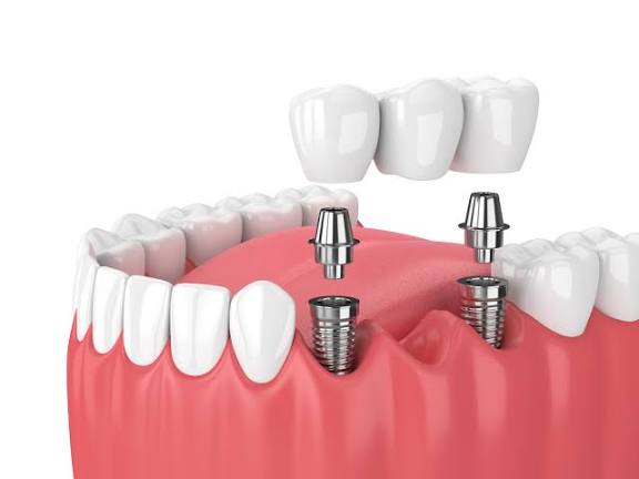 Dr Bashis Dental Clinic