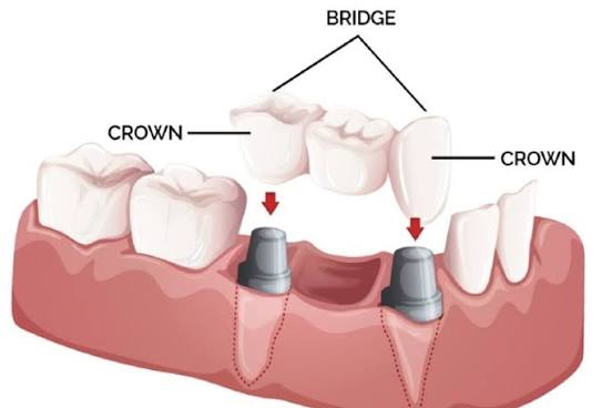 Dr Bashis Dental Clinic